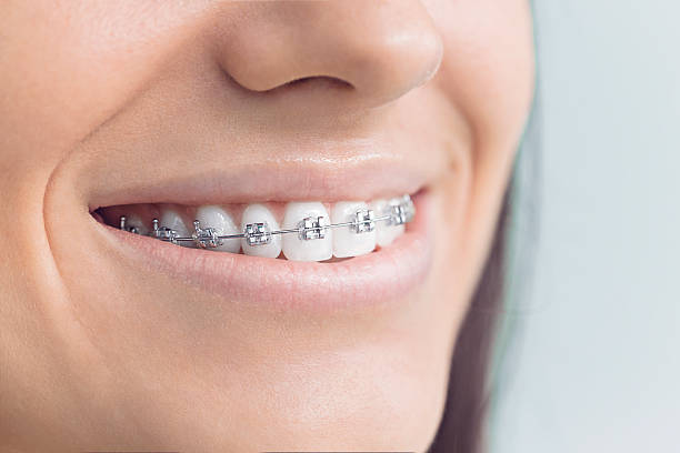 Best Teeth Whitening  in Sierra Madre, CA